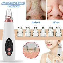 Load image into Gallery viewer, USB Rechargeable Blackhead Remover Face Pore Vacuum Skin Care Acne Pore Cleaner Pimple Removal Vacuum Suction Facial Tools Itdinos