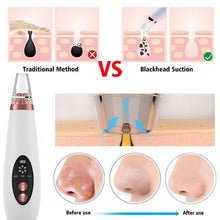 Load image into Gallery viewer, USB Rechargeable Blackhead Remover Face Pore Vacuum Skin Care Acne Pore Cleaner Pimple Removal Vacuum Suction Facial Tools Itdinos